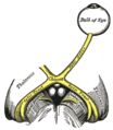 Septo-optic dysplasia