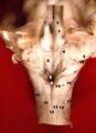 Sulcus limitans