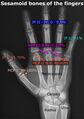 Sesamoid bones of the fingers
