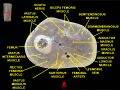 Histological slide of muscle tissue
