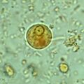 Entamoeba histolytica cyst