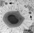 Giant Mimivirus with satellite Sputnik virophages