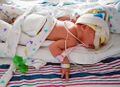 Neonatal intensive care unit