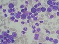 Blood smear
