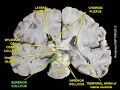 Superior colliculus
