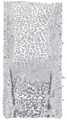 Endochondral ossification