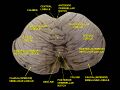 Central lobule