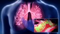 Respiratory Tract